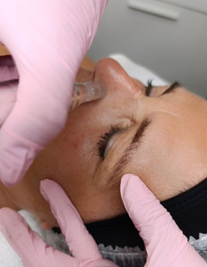 Limpieza facial profunda y tratamientos de rejuvenecimiento